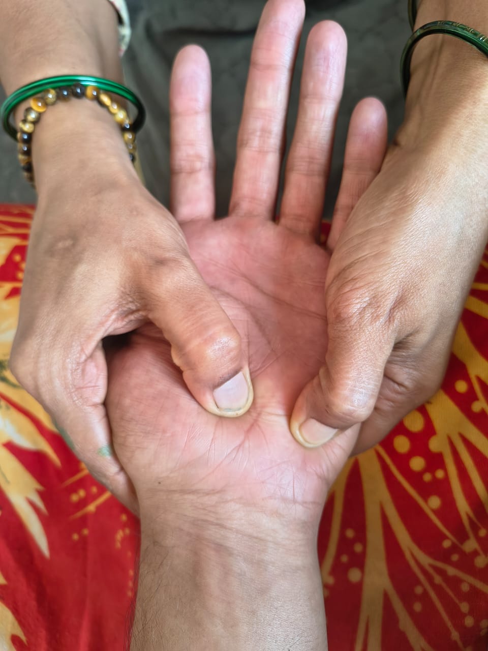 Acupressure Therapy